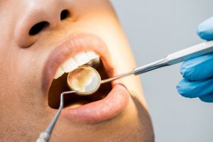 Odontologas patikrina jūsų dantis veidrodžiu